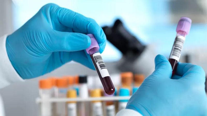 El prometedor examen de sangre para detectar más de 50 tipos cáncer que tiene entusiasmados a los científicos